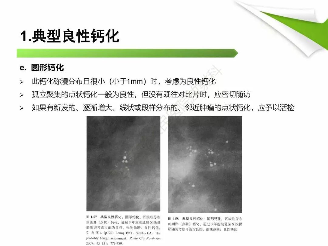 【PPT】乳腺X线影像表现与术语规范