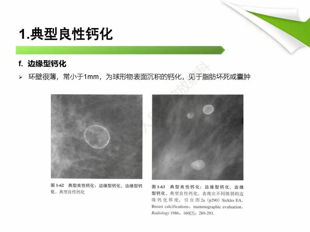 【PPT】乳腺X线影像表现与术语规范
