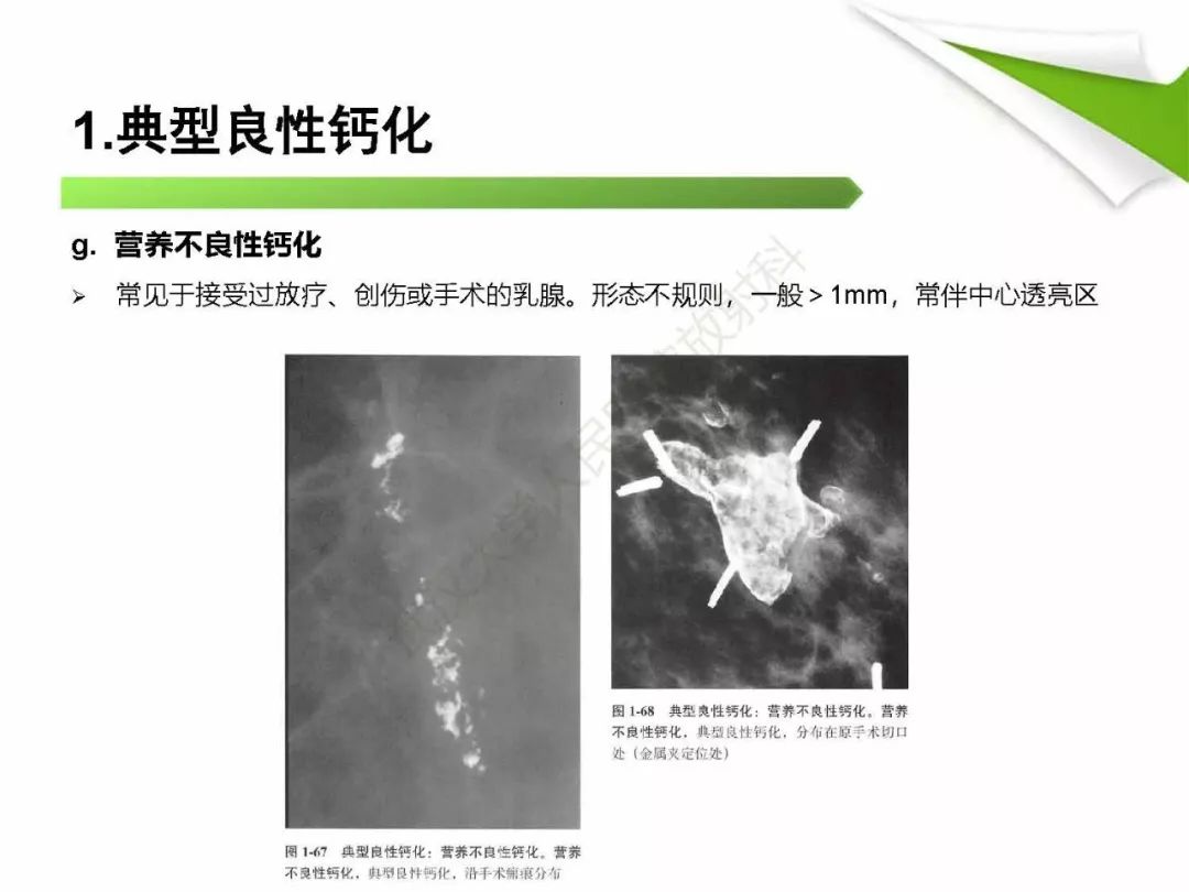 【PPT】乳腺X线影像表现与术语规范