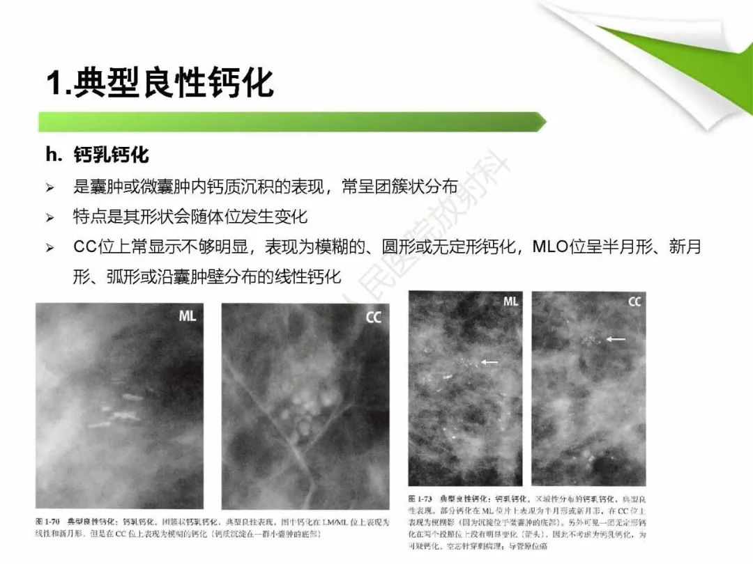 【PPT】乳腺X线影像表现与术语规范