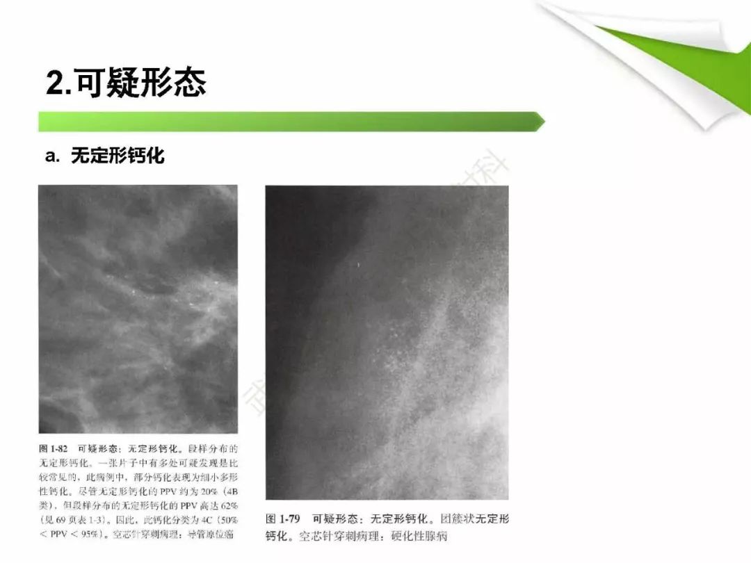 【PPT】乳腺X线影像表现与术语规范