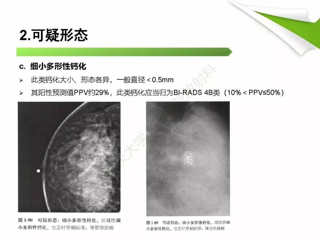 【PPT】乳腺X线影像表现与术语规范