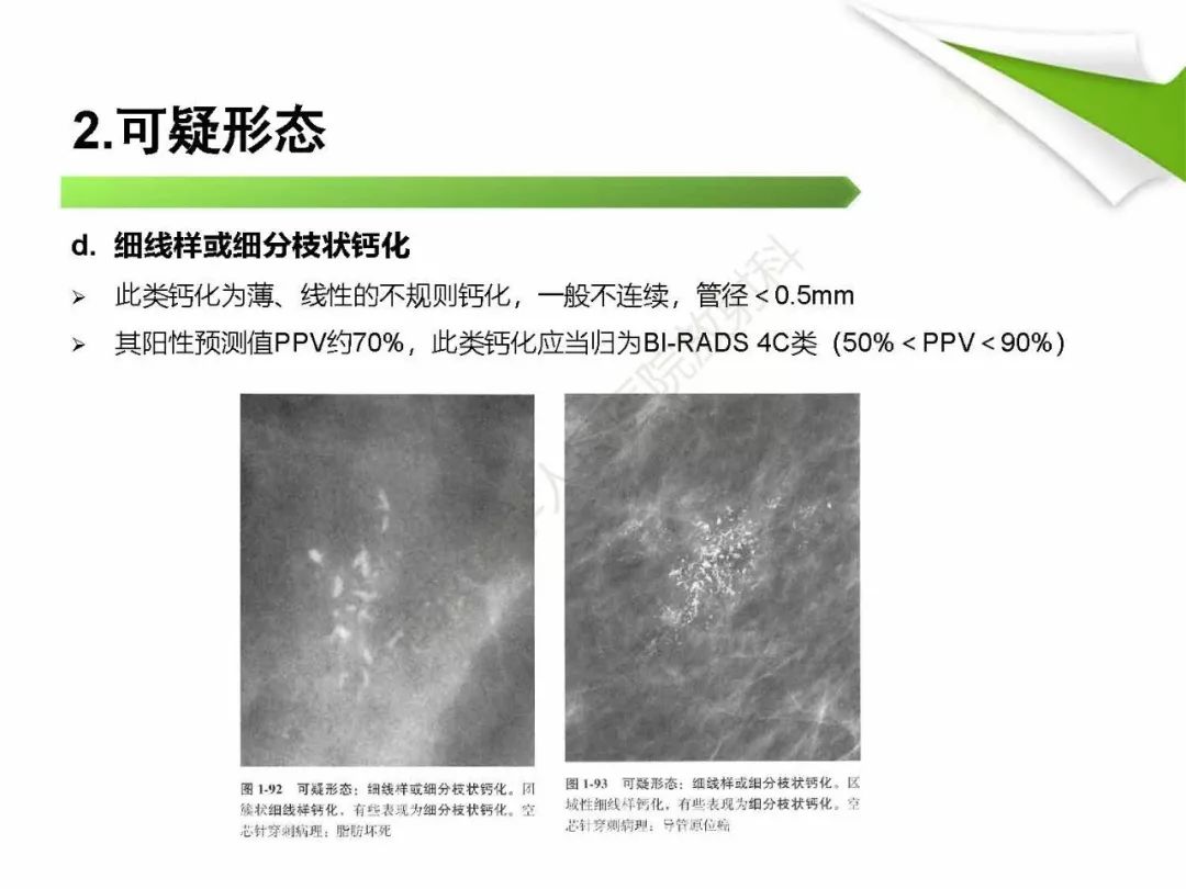 【PPT】乳腺X线影像表现与术语规范
