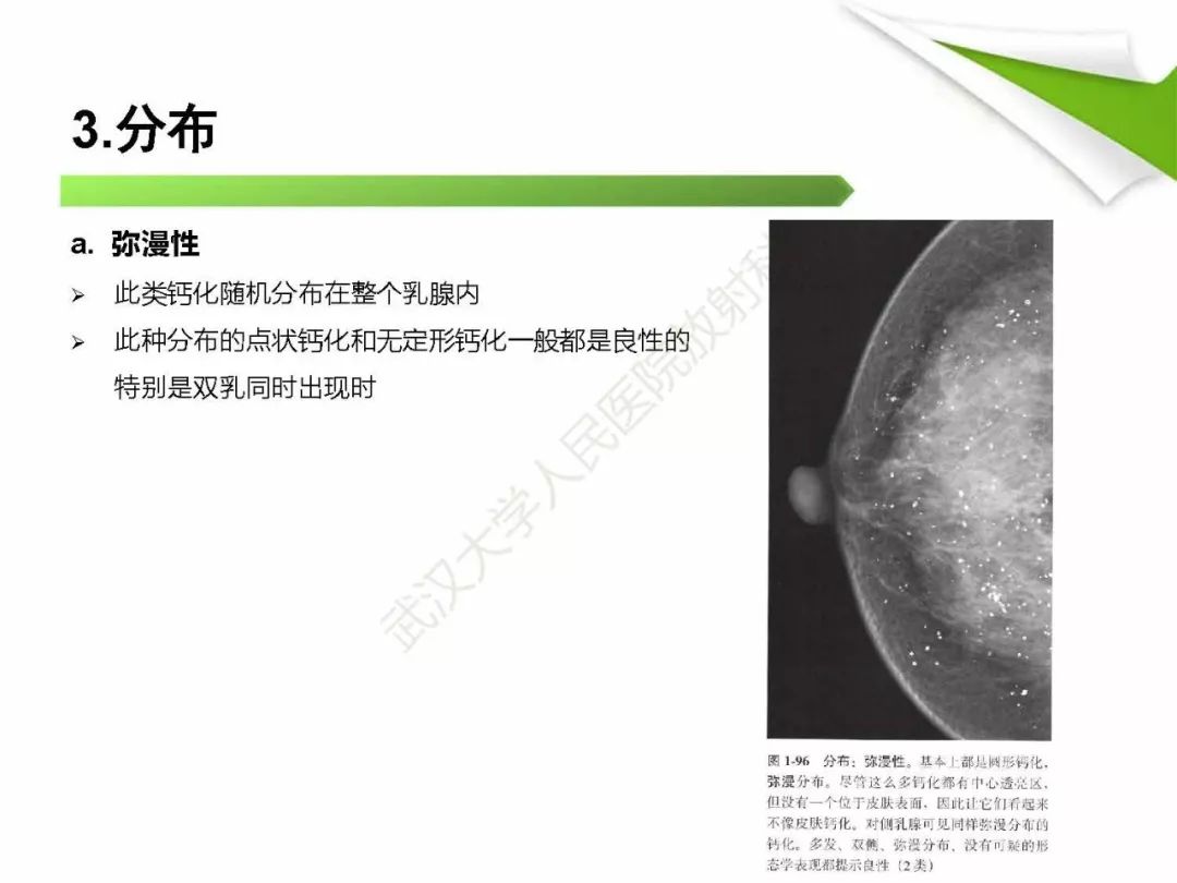 【PPT】乳腺X线影像表现与术语规范