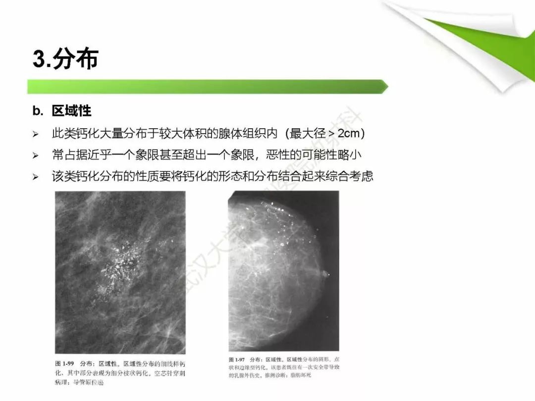 【PPT】乳腺X线影像表现与术语规范