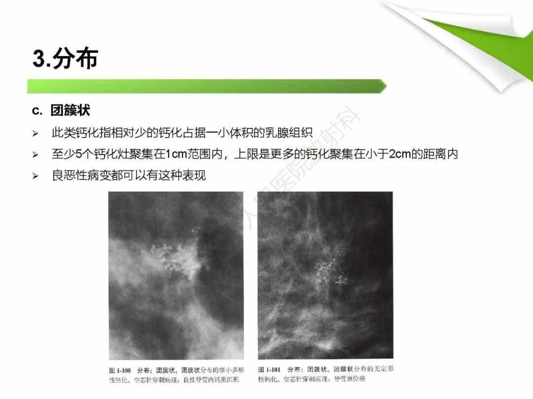 【PPT】乳腺X线影像表现与术语规范