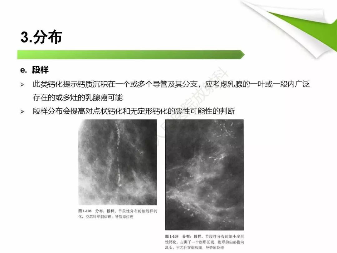 【PPT】乳腺X线影像表现与术语规范
