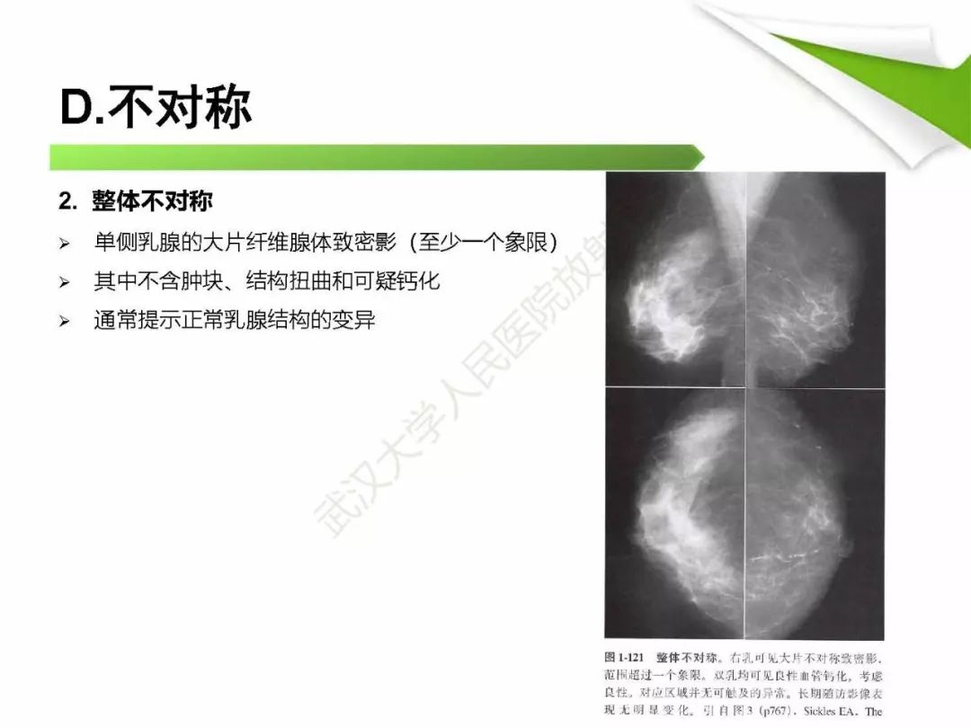 【PPT】乳腺X线影像表现与术语规范