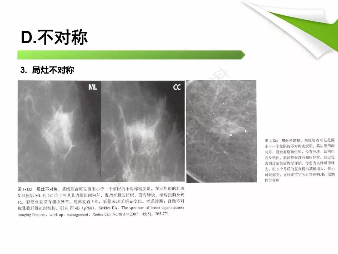 【PPT】乳腺X线影像表现与术语规范