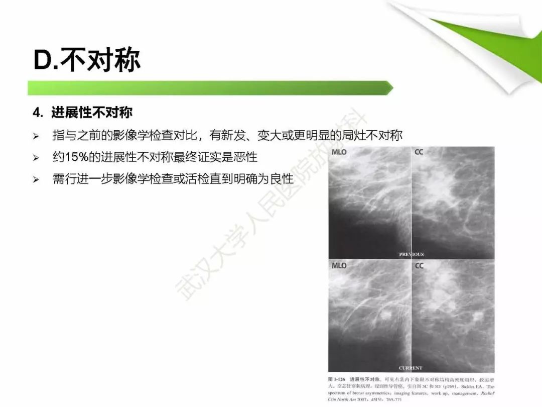 【PPT】乳腺X线影像表现与术语规范
