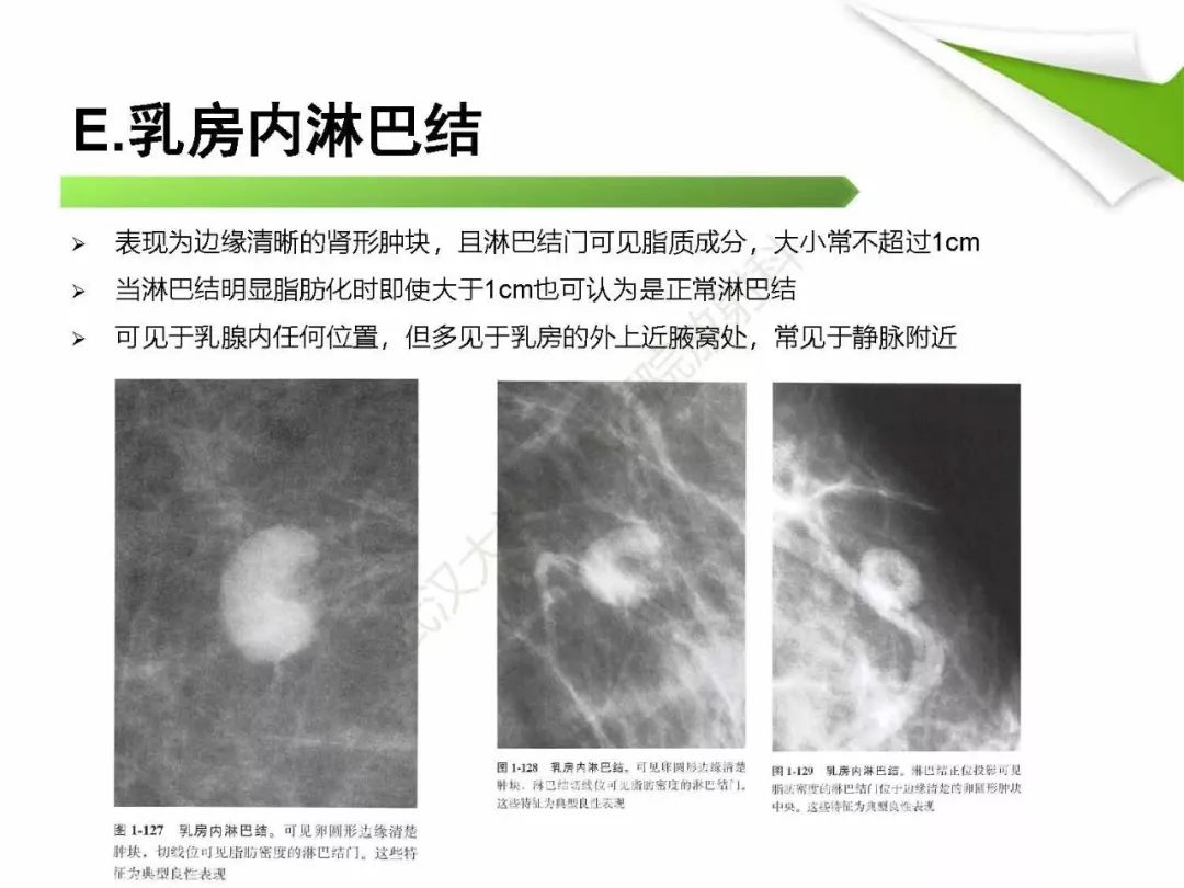 【PPT】乳腺X线影像表现与术语规范