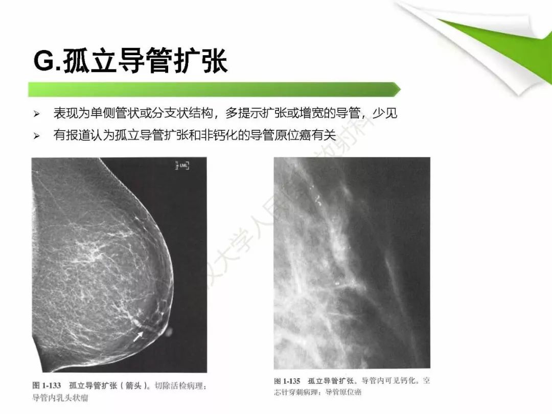 【PPT】乳腺X线影像表现与术语规范