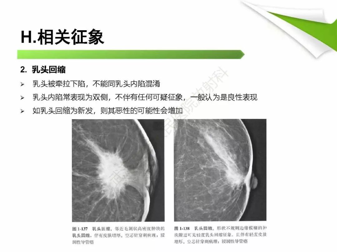 【PPT】乳腺X线影像表现与术语规范