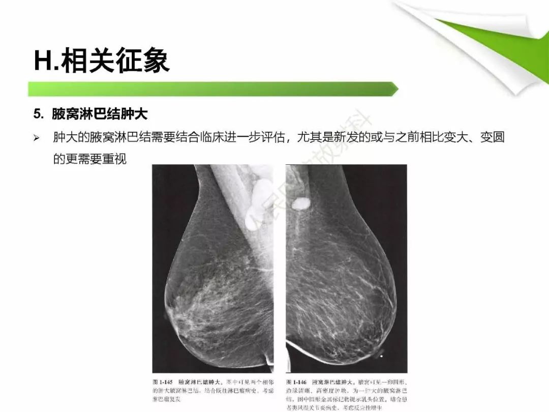 【PPT】乳腺X线影像表现与术语规范