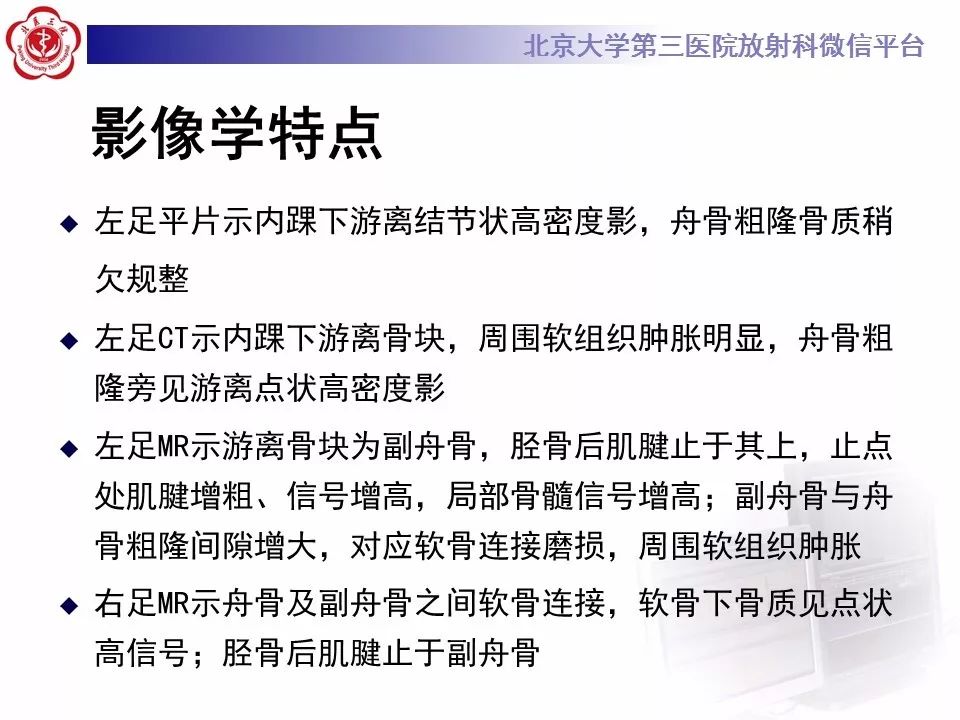 【病例】足副舟骨损伤1例X线CT及MR