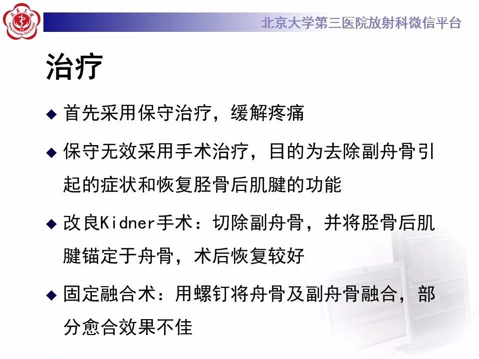 【病例】足副舟骨损伤1例X线CT及MR