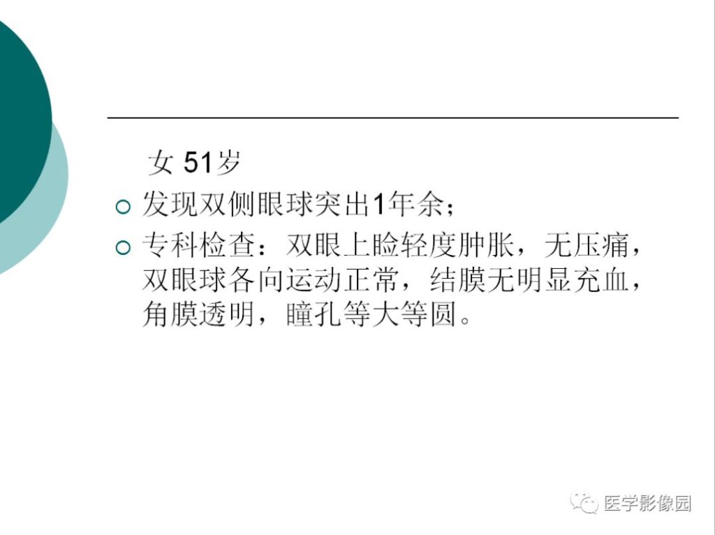 【病例】眼眶炎性假瘤1例CT影像表现