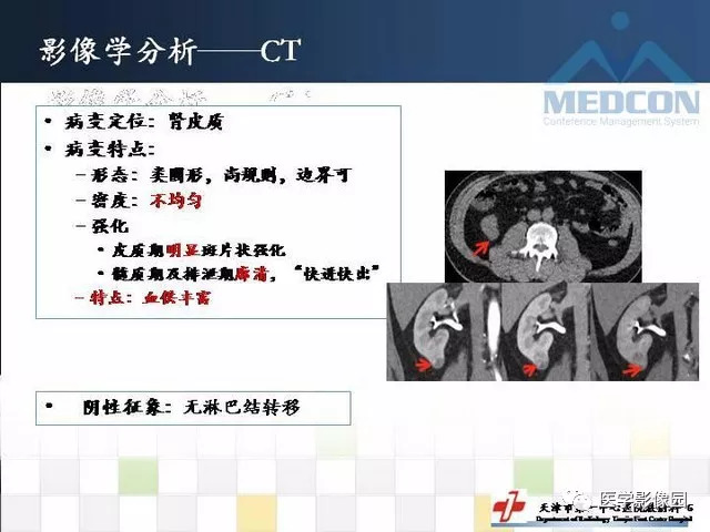 【PPT】