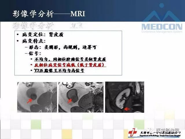 【PPT】