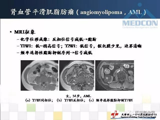 【PPT】