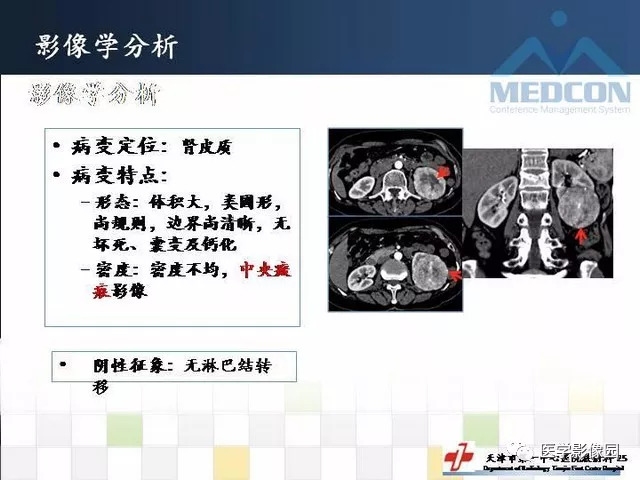 【PPT】