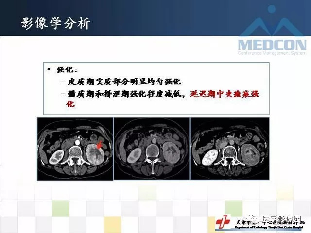 【PPT】