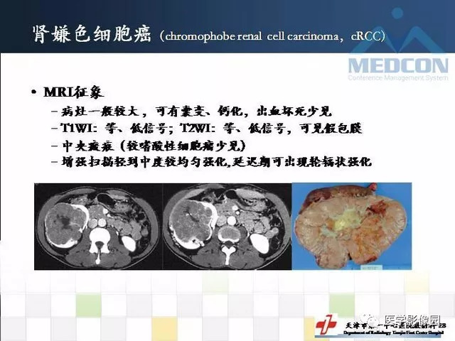 【PPT】