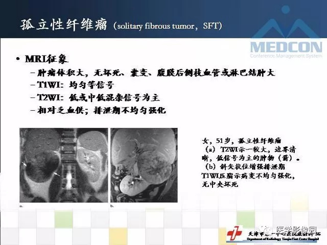【PPT】