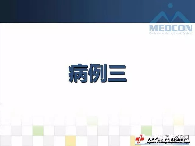 【PPT】