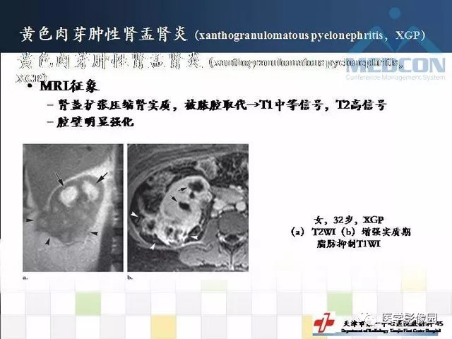【PPT】
