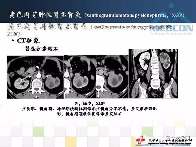【PPT】