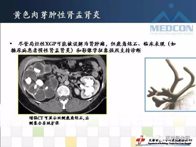 【PPT】