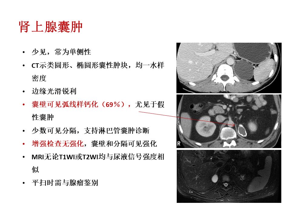 【PPT】肾上腺常见疾病的影像学表现