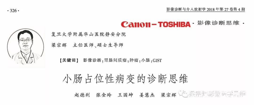 【病例】小肠间质瘤1例CT影像诊断思维