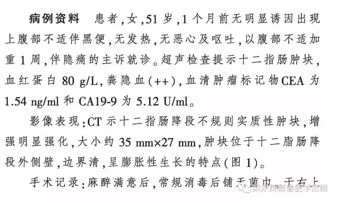 【病例】小肠间质瘤1例CT影像诊断思维