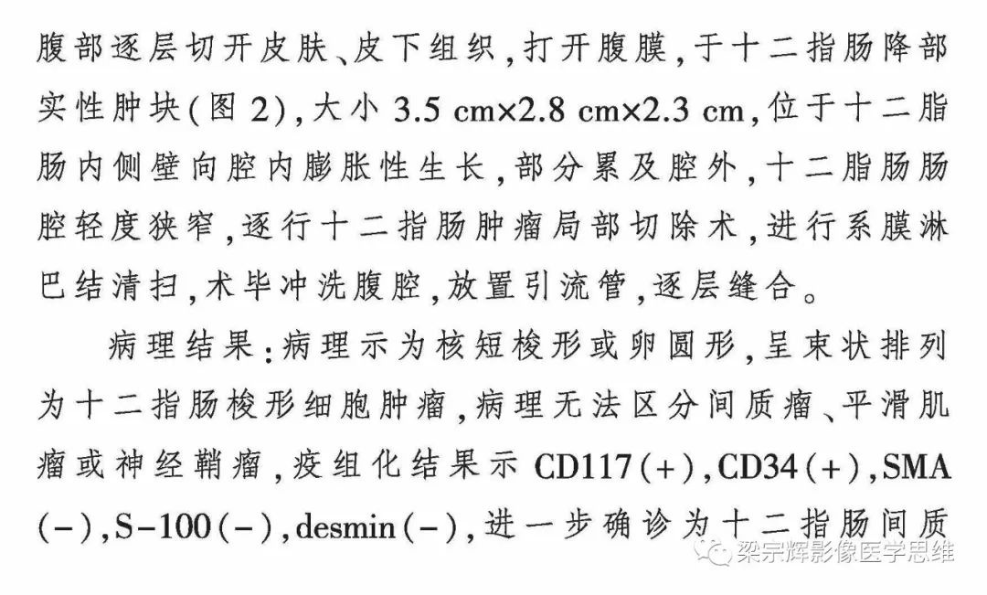 【病例】小肠间质瘤1例CT影像诊断思维