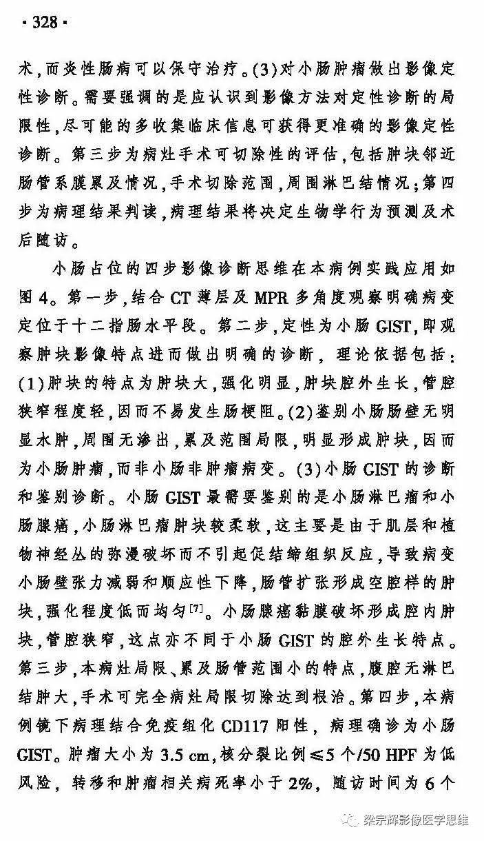 【病例】小肠间质瘤1例CT影像诊断思维