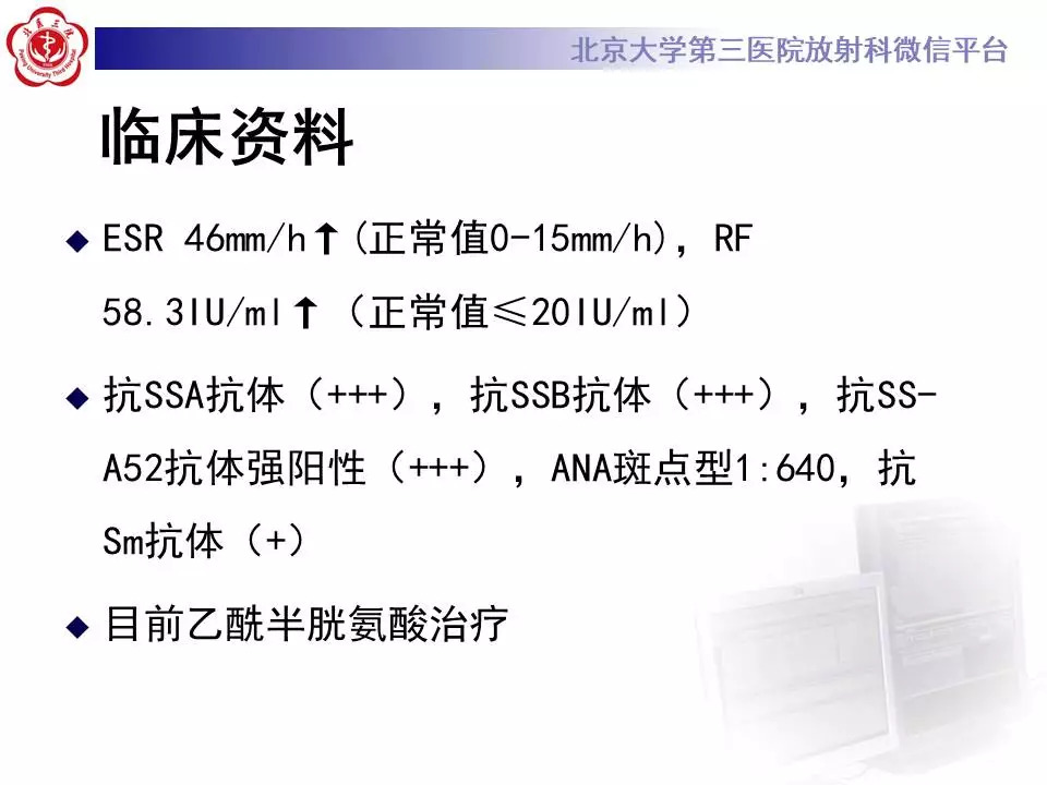 【病例】干燥综合征相关寻常型间质性肺炎1例CT影像表现