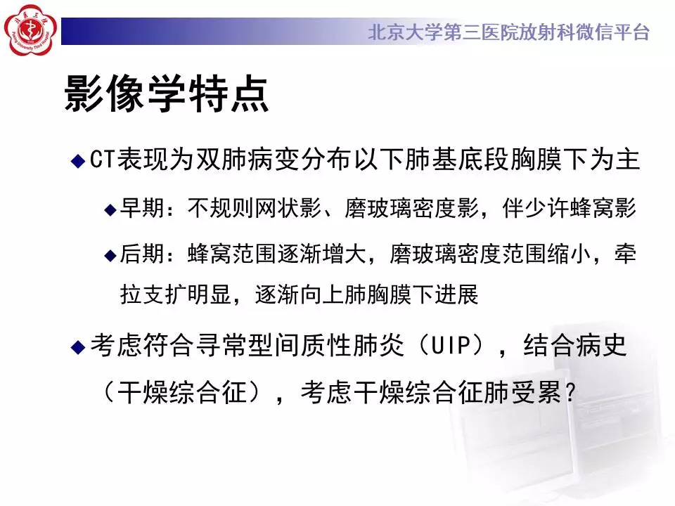 【病例】干燥综合征相关寻常型间质性肺炎1例CT影像表现