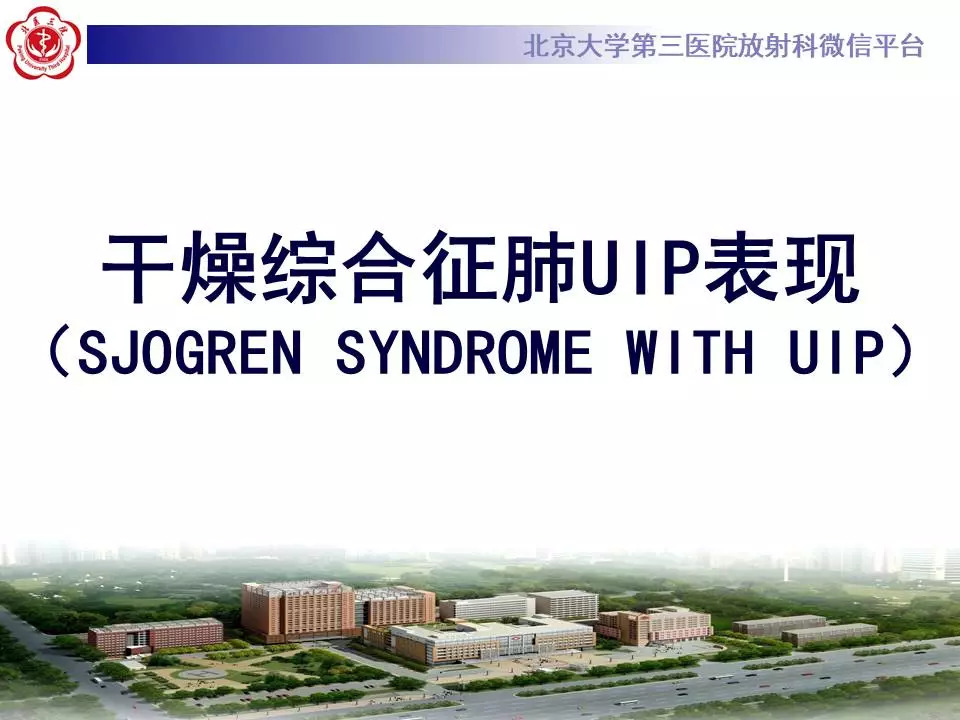 【病例】干燥综合征相关寻常型间质性肺炎1例CT影像表现