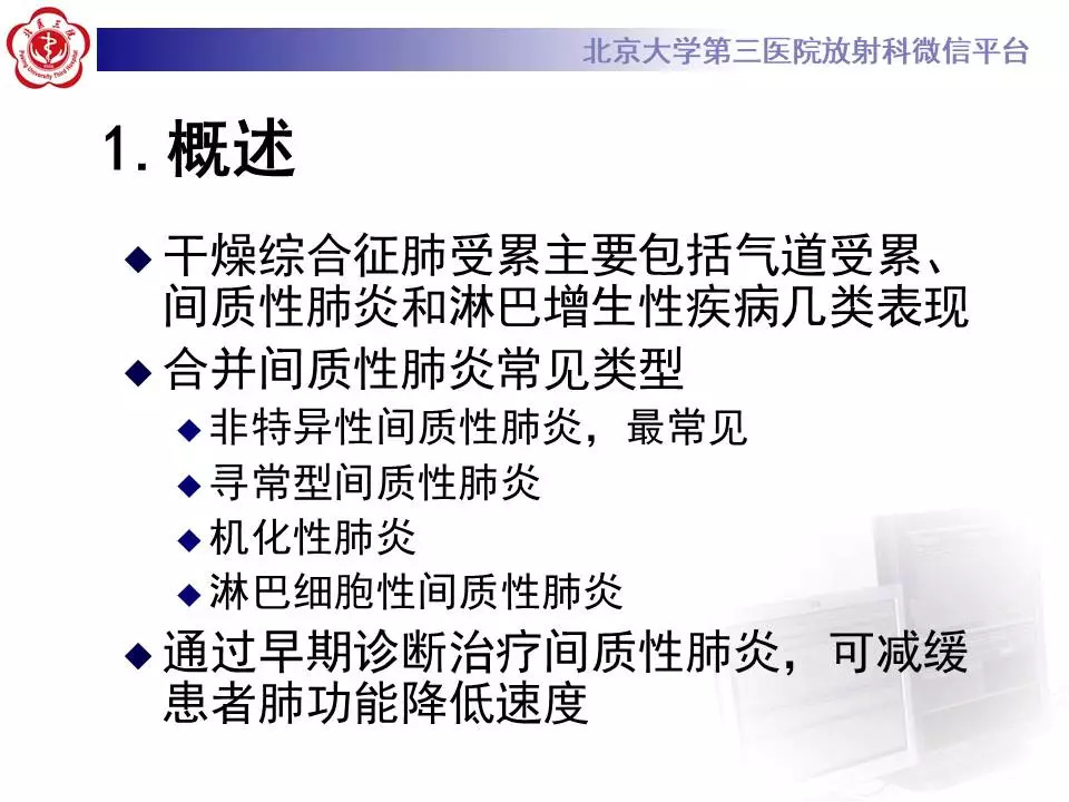 【病例】干燥综合征相关寻常型间质性肺炎1例CT影像表现