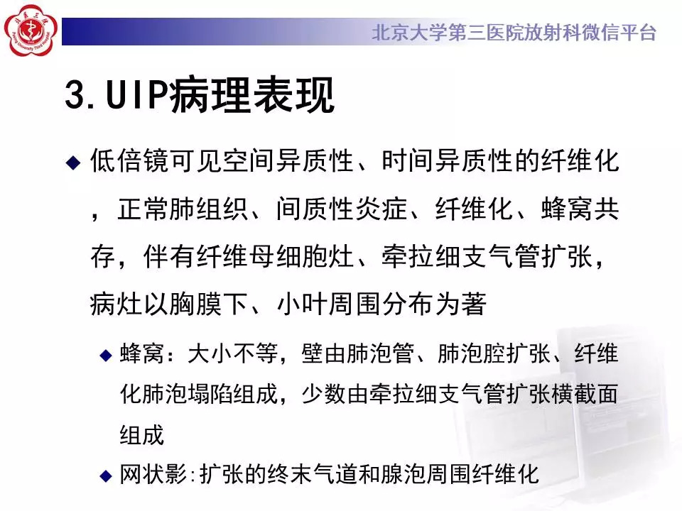 【病例】干燥综合征相关寻常型间质性肺炎1例CT影像表现