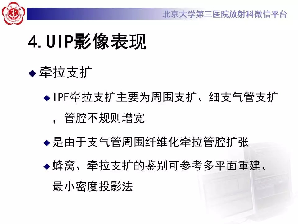 【病例】干燥综合征相关寻常型间质性肺炎1例CT影像表现