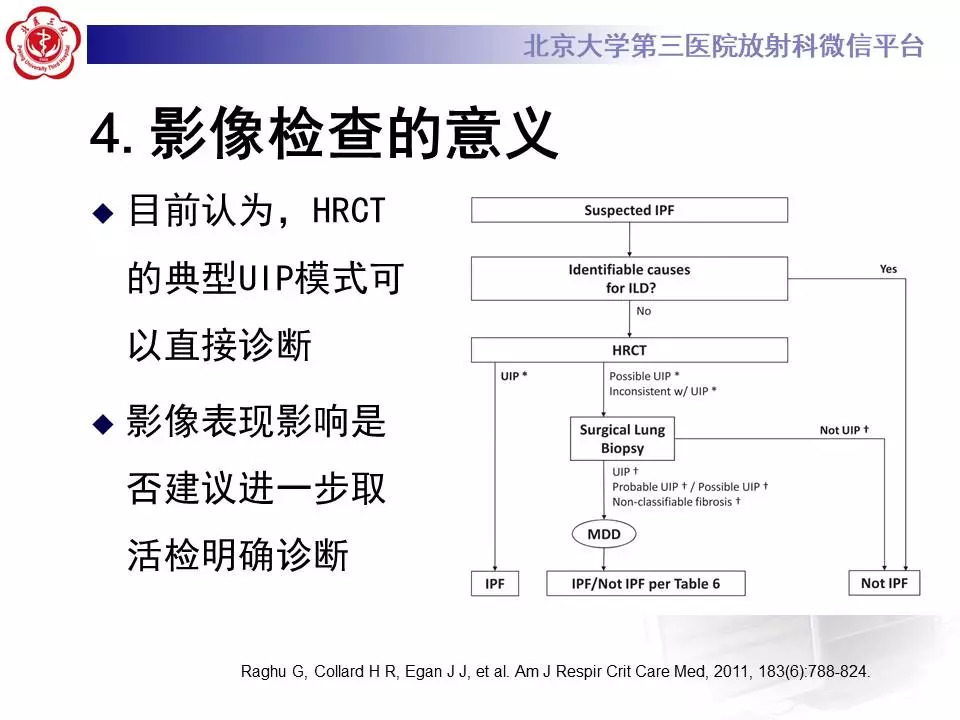 【病例】干燥综合征相关寻常型间质性肺炎1例CT影像表现