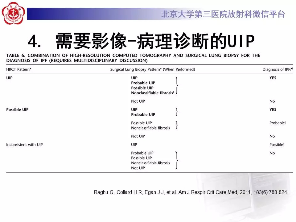 【病例】干燥综合征相关寻常型间质性肺炎1例CT影像表现