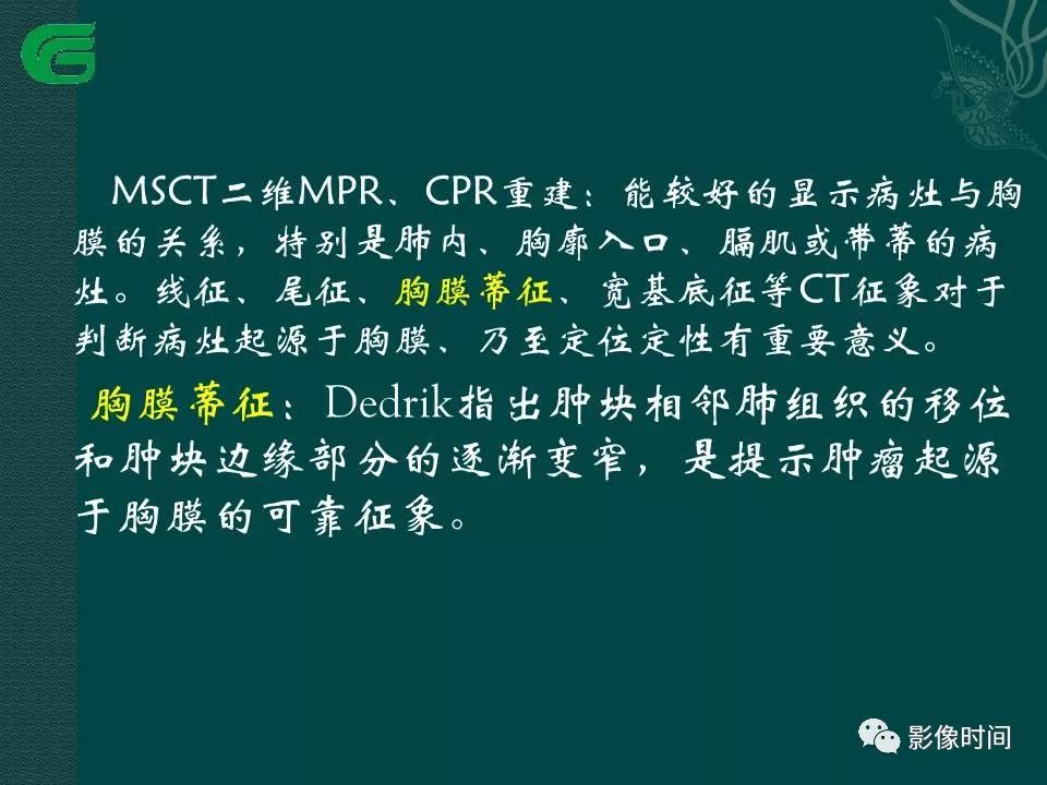 【PPT】胸膜孤立性纤维瘤的CT诊断与鉴别诊断