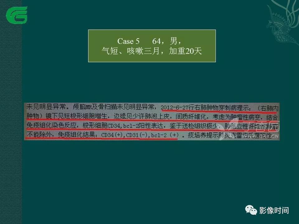 【PPT】胸膜孤立性纤维瘤的CT诊断与鉴别诊断
