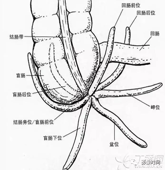 急性阑尾炎CT诊断 急性阑尾炎CT诊断