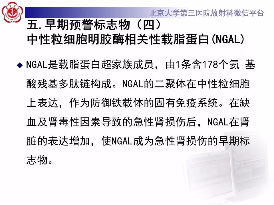 【PPT】造影剂肾病
