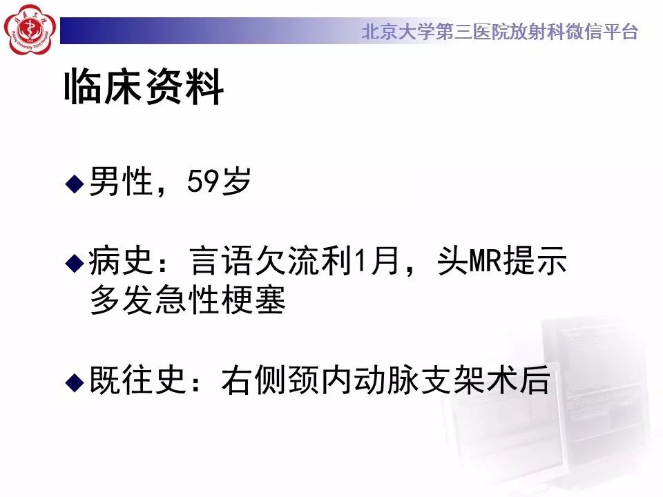 【病例】烟雾病1例CT及MR影像表现